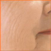 Knitterfalten Wolfsburg